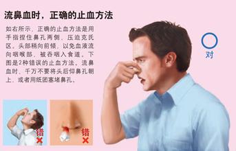 流鼻血怎么能快速止血，鼻出血的正確止血方法